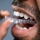 Invisalign Doctor Login: A Comprehensive Guide